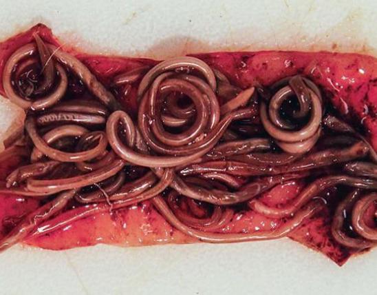 Closeup of intestine full of ringworms